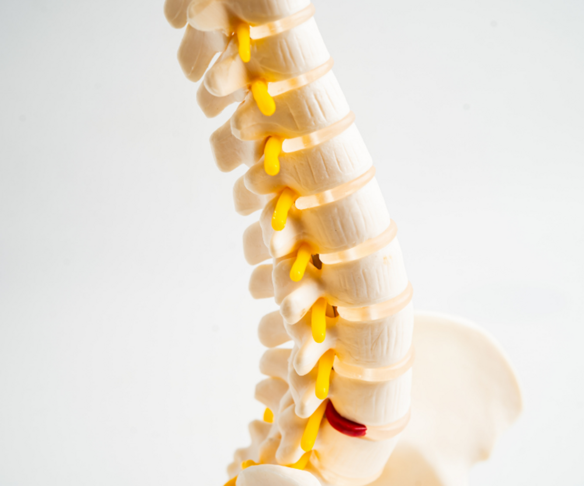 Lumbar Spinal Stenosis
