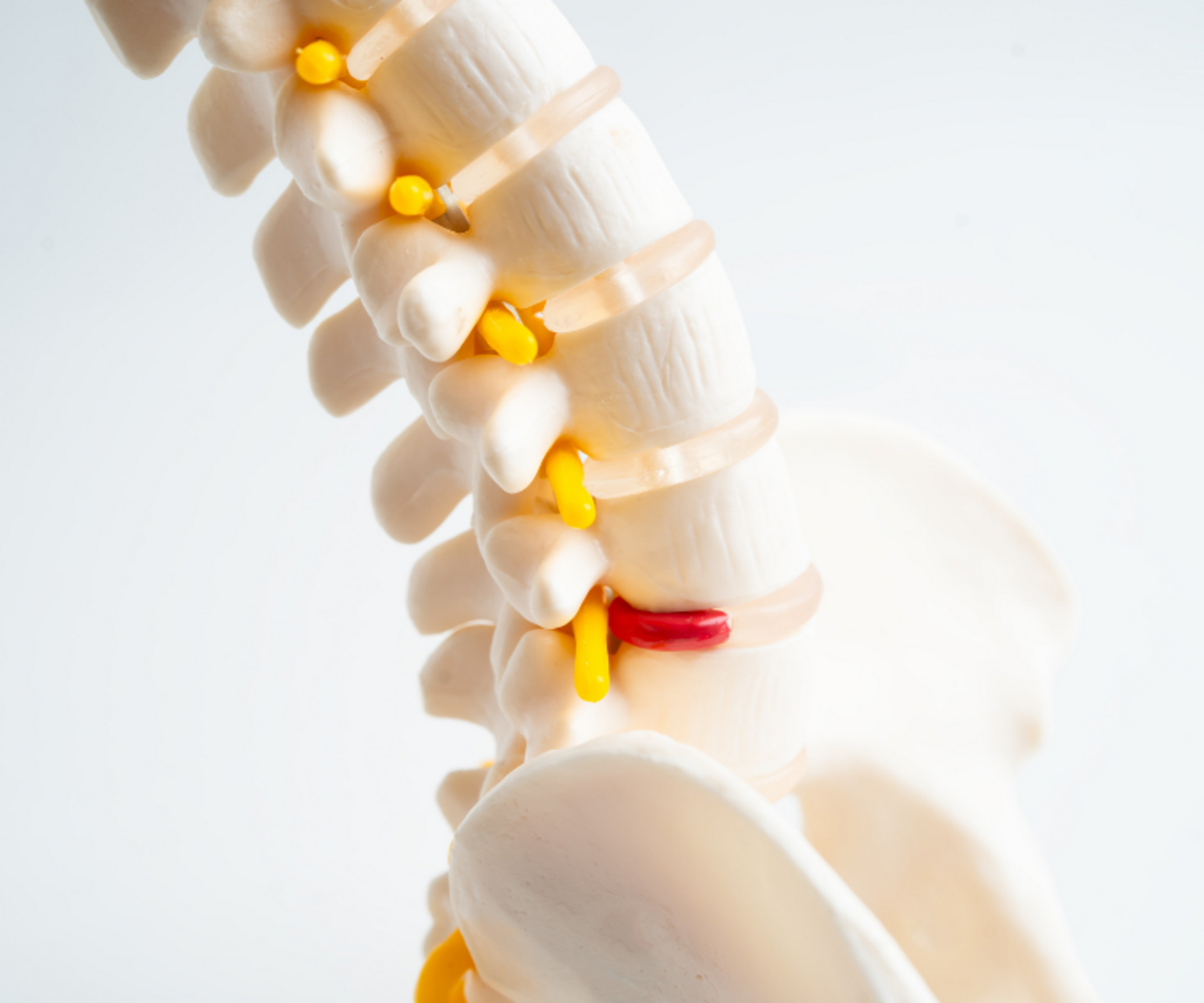 Degenerative Spine Conditions | Dr. Rajat Mahajan